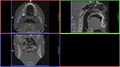 Burien Oral and Maxillofacial Imaging image 5