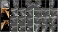 Burien Oral and Maxillofacial Imaging image 6