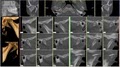 Burien Oral and Maxillofacial Imaging image 6