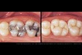 Christopher J. Bouldin, DDS. & Associates image 8