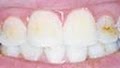 Cornerstone Dental image 2
