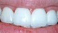 Cornerstone Dental image 3