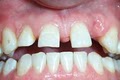 Cornerstone Dental image 4