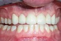 Cornerstone Dental image 5