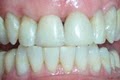 Cornerstone Dental image 6