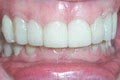 Cornerstone Dental image 7