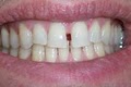 Cornerstone Dental image 8