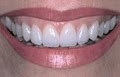 Dental Care West image 1