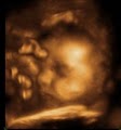 Enlightened 3D / 4D Imaging & Photography - 3D/4D Ultrasound image 2