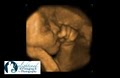 Enlightened 3D / 4D Imaging & Photography - 3D/4D Ultrasound image 1
