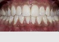 Fairfax Area Family Dental Care- Emergency Dentist image 2