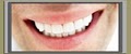 Family and Cosmetic Dentistry Shelton image 3