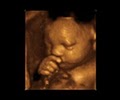 First Expressions Columbus 3D & 4D Ultrasound image 2