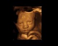 First Expressions Columbus 3D & 4D Ultrasound image 3