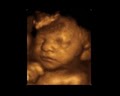 First Expressions Columbus 3D & 4D Ultrasound image 5