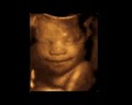 First Expressions Columbus 3D & 4D Ultrasound image 6