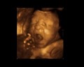 First Expressions Columbus 3D & 4D Ultrasound image 7