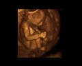 First Expressions Columbus 3D & 4D Ultrasound image 9