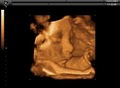 First View 3D 4D Ultrasound Center Northwest Denver Metro image 2
