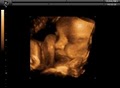 First View 3D 4D Ultrasound Center Northwest Denver Metro image 3