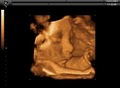 First View 3D 4D Ultrasound Center South Denver Metro logo