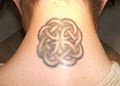 INK-B-GONE Precision Laser Tattoo Removal image 2
