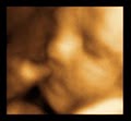 Peek A Baby Willowbrook         2D/3D/4D Ultrasound  Center image 2