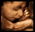 Peek A Baby Willowbrook         2D/3D/4D Ultrasound  Center image 3