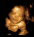 Peek A Baby Willowbrook         2D/3D/4D Ultrasound  Center logo