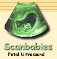 Scanbabies image 1