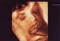 Sneak-A-Peek Ultrasounds image 2