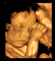 Sneak-A-Peek Ultrasounds image 1