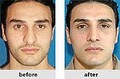 The Kahn Center for Cosmetic Surgery image 4