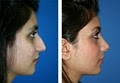The Kahn Center for Cosmetic Surgery image 6