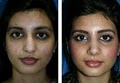 The Kahn Center for Cosmetic Surgery image 7