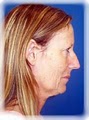 The Kahn Center for Cosmetic Surgery image 8