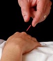 Tigerlily Acupuncture image 2