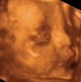 3D Baby Ultrasound Houston image 2