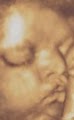 3D Baby Ultrasound Houston image 3