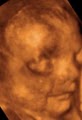3D Baby Ultrasound Houston image 4