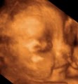 3D Baby Ultrasound Houston image 5