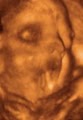 3D Baby Ultrasound Houston image 6