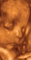 3D Baby Ultrasound Houston image 7