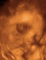 3D Baby Ultrasound Houston image 8