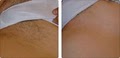 ADVANCED LASER HAIR REMOVAL SOLUTIONS image 10