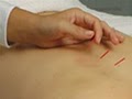 An Sen Acupuncture and Massage image 2