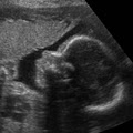 Anticipation Ultrasound Studio image 8