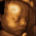 Anticipation Ultrasound Studio image 10