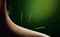 Arlington Acupuncture Clinic image 2
