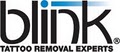 Blink Tattoo Removal image 1